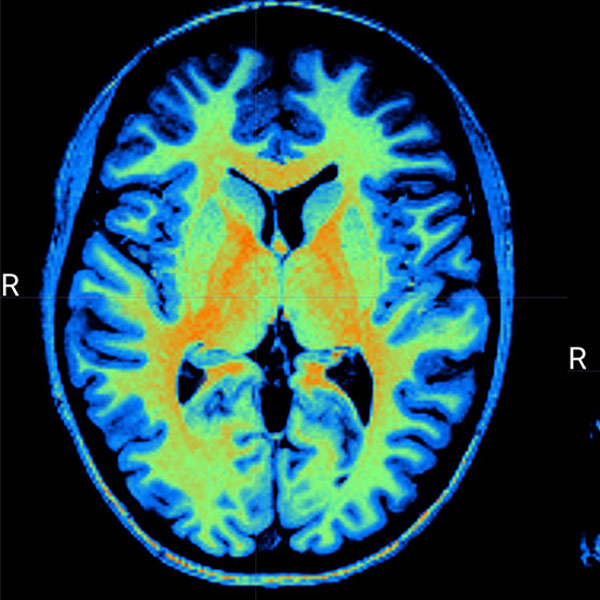 Multicolored brain scan on computer screen 
